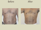 Before & After Photo