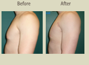 Before & After Photo