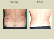 Before & After Photo