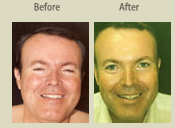 Before & After Photo