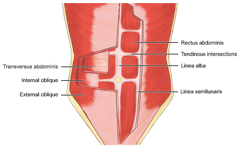 Hi Def Lipo Target Areas