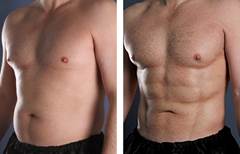 Hi Def Lipo 05