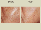 Before & After Photo