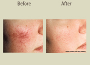 Before & After Photo