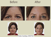 Before & After Photo