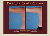 Before & After Photo