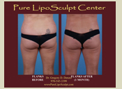 Before & After Photo