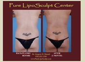 Before & After Photo