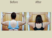 Before & After Photo