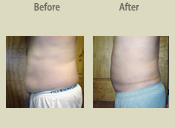 Before & After Photo