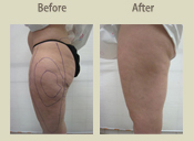 Before & After Photo