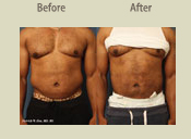 Before & After Photo