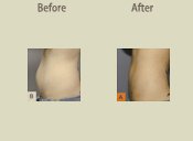 Before & After Photo