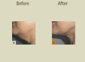 Before & After Photo