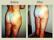 Before & After Photo