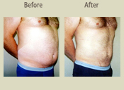Before & After Photo