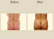 Before & After Photo