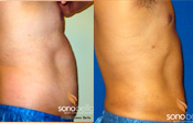 Before & After Photo