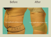 Before & After Photo