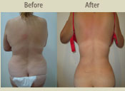 Before & After Photo