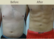 Before & After Photo