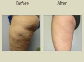 Before & After Photo