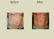 Before & After Photo