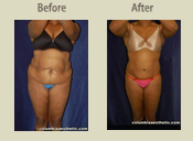 Before & After Photo