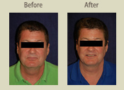 Before & After Photo