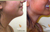 Before & After Photo