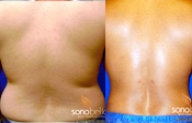 Before & After Photo