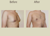 Before & After Photo