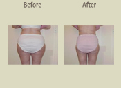 Before & After Photo