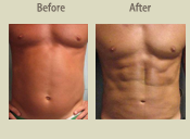 Before & After Photo
