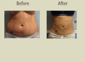 Before & After Photo
