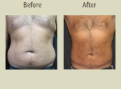 Before & After Photo