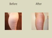 Before & After Photo