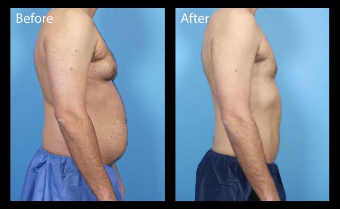 Before & After Photo