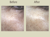 Before & After Photo