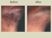 Before & After Photo