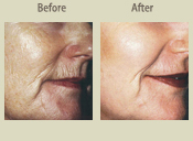 Before & After Photo