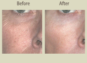 Before & After Photo