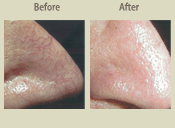 Before & After Photo
