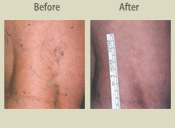 Before & After Photo