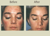 Before & After Photo