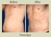 Before & After Photo