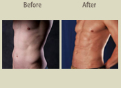 Before & After Photo