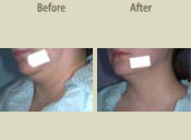 Before & After Photo